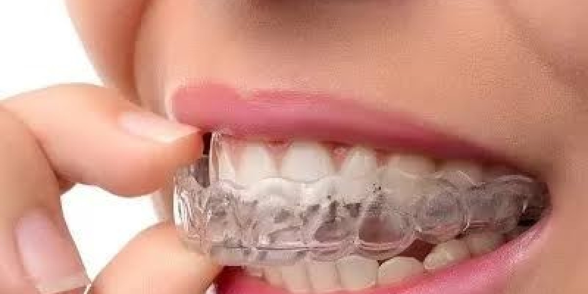 Dental Implants in Dubai for Busy Professionals | A Long-Lasting Smile Solution