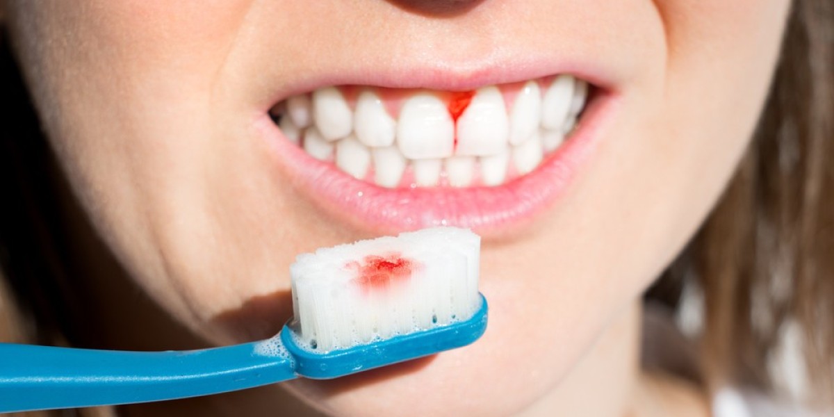 Common Types of Gum Treatment Explained