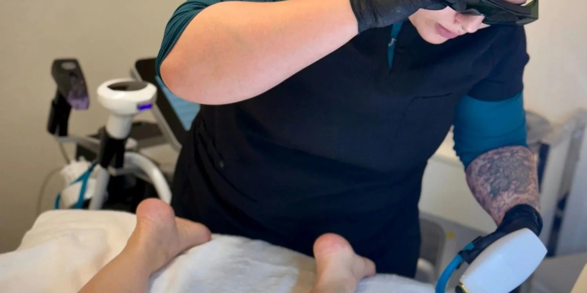 How Many Sessions for Laser Hair Removal on Legs? Your Complete Guide