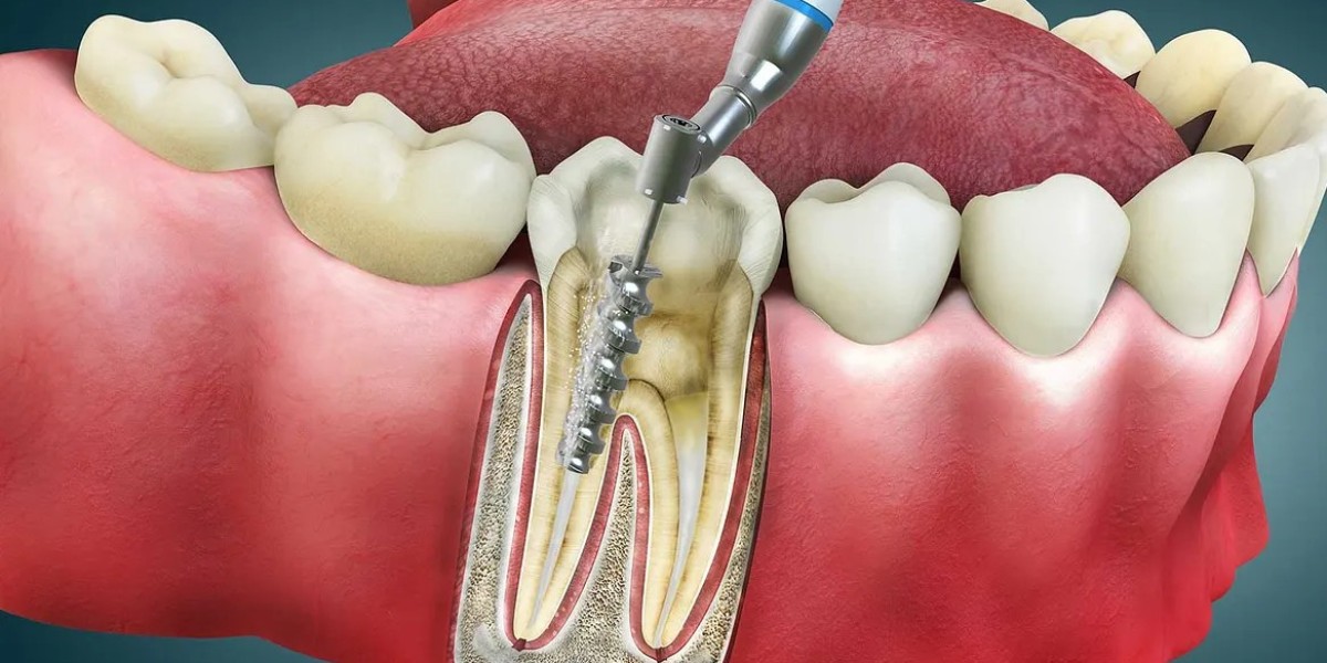 The Modern Dental Solution for Pain-Free and Healthy Teeth