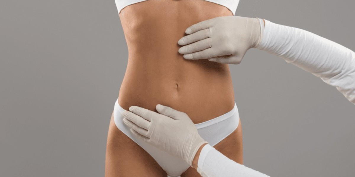 Liposuction surgery in Dubai Safety and Risk Insights