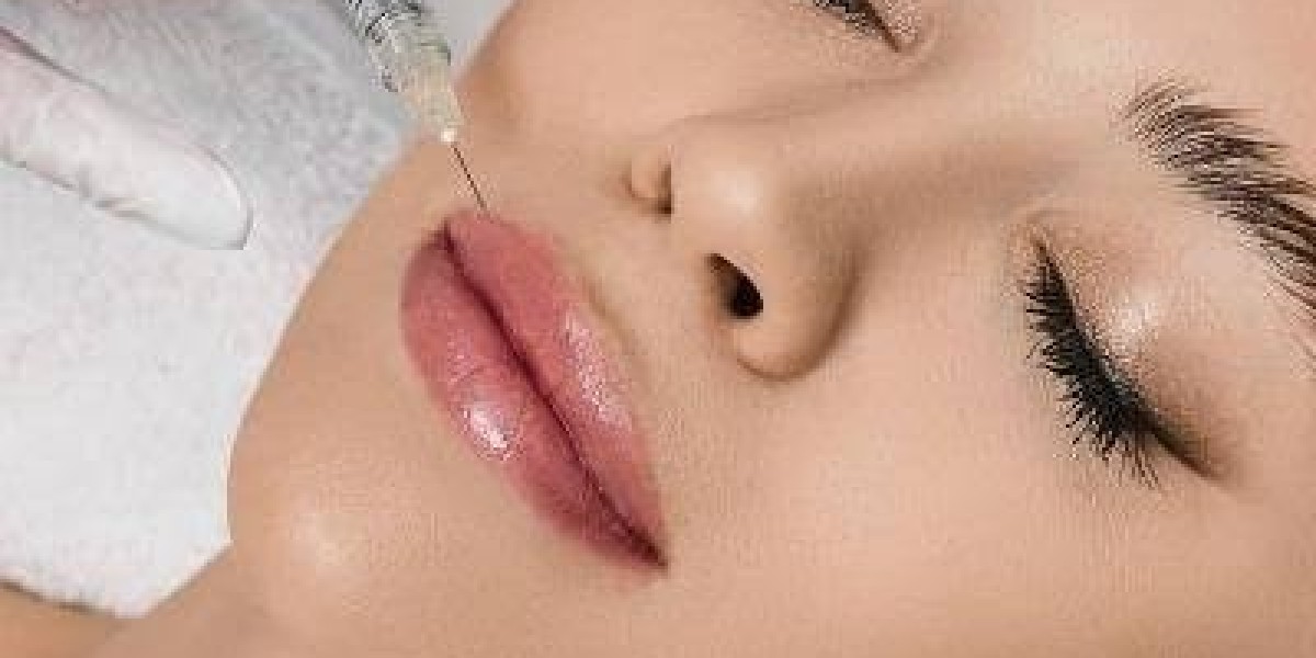 Lip Reduction Treatment for Harmonious Smile Aesthetics