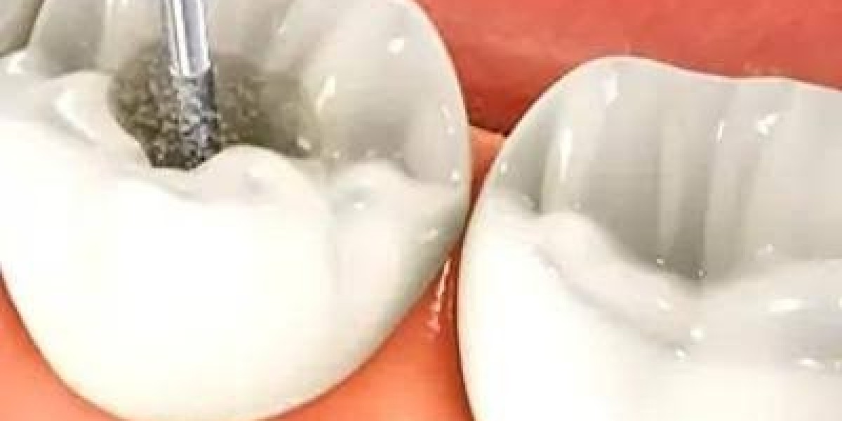 Root Canal Treatment With Inflammation in Dubai | Complete Guide to Saving Infected Teeth