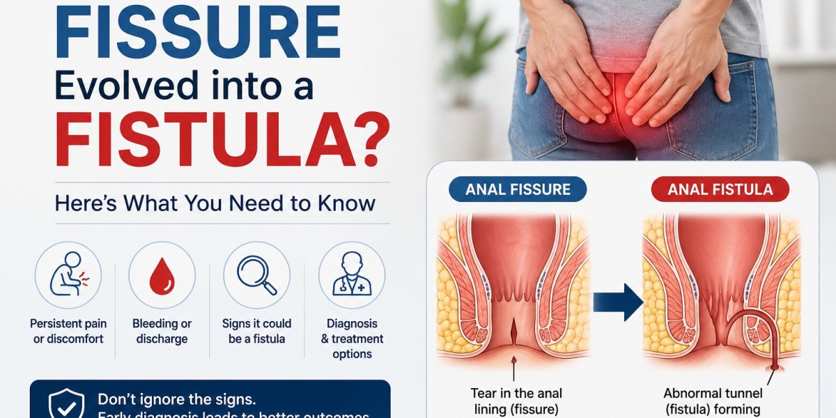 Has Your Fissure Evolved into a Fistula? Here’s What You Need to Know