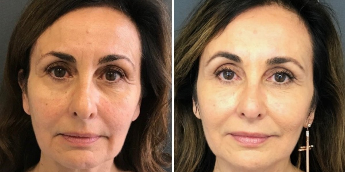 How Regenerative Medicine is Shaping Beauty Standards in Saudi Arabia