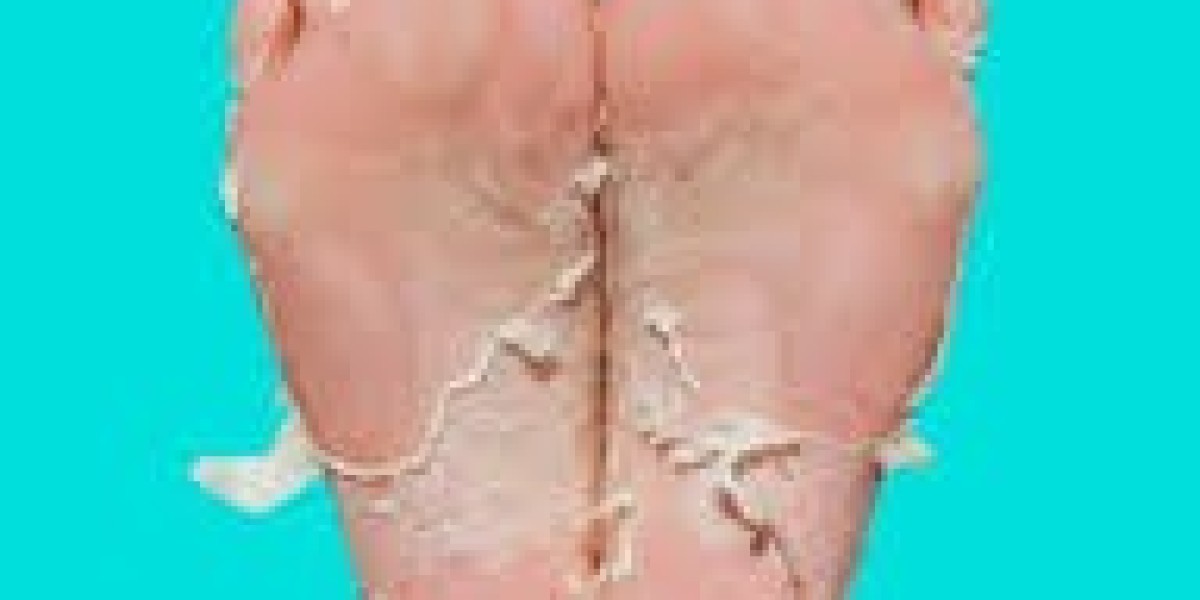Leg Peel in Dubai: The Secret to Smooth and Radiant Legs