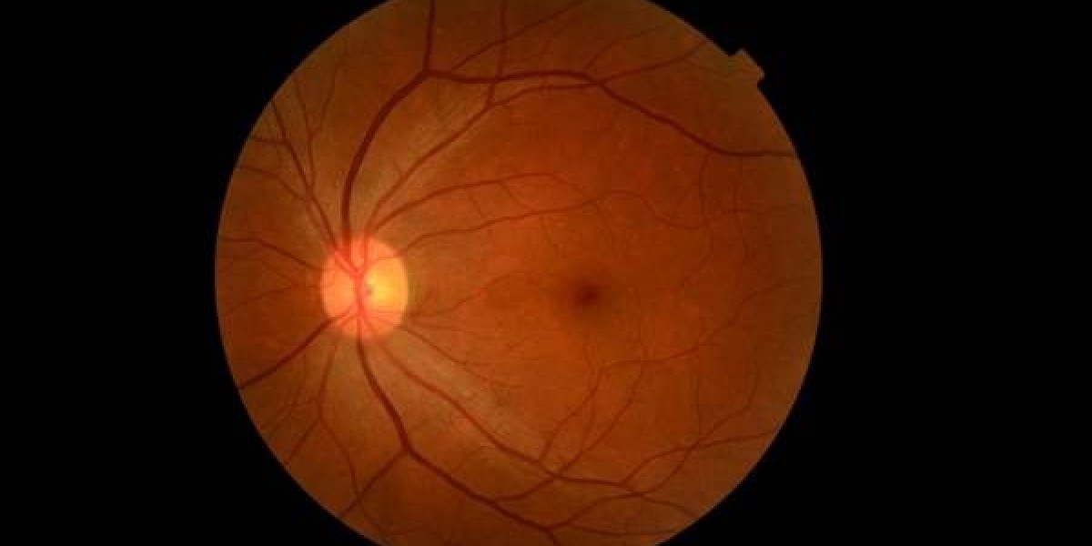 Diabetic Retinopathy Treatment in Pune