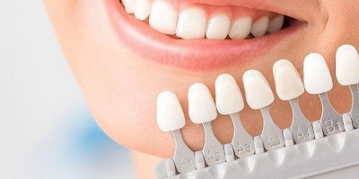 Zirconia Crowns in Dubai | Durable and Natural Dental Restoration