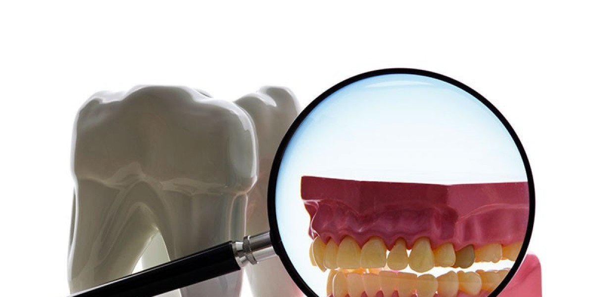 Root Canal Care to Protect Your Tooth