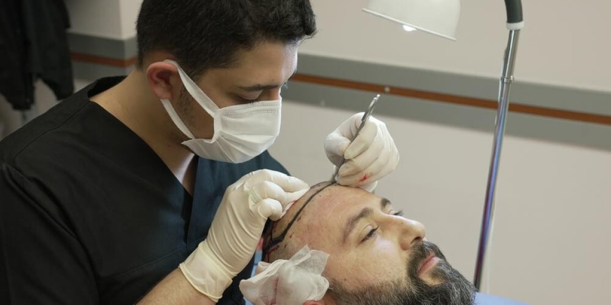 زراعة الشعر في بريدة للرجال والنساء