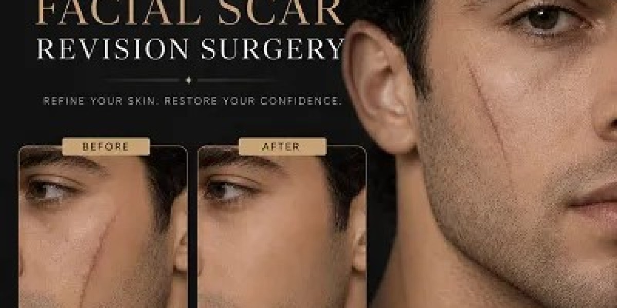 Reclaim Clearer Skin Through Scar Revision