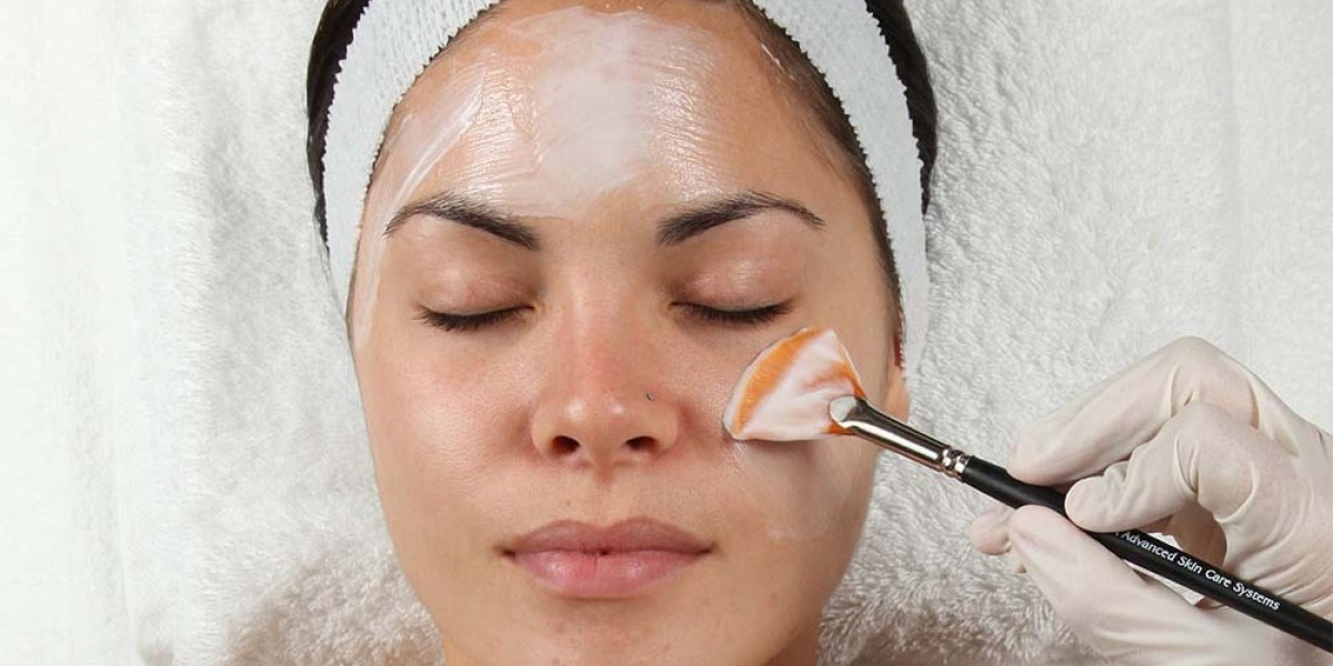 Can PCA Peel Treatment Enhance Skin Texture Naturally?