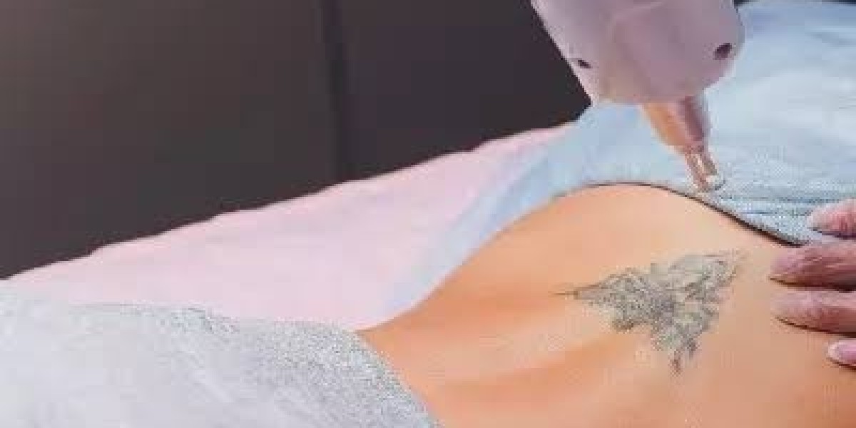 Full Back Laser in Dubai: Your Guide to Smooth, Long-Lasting Hair Reduction