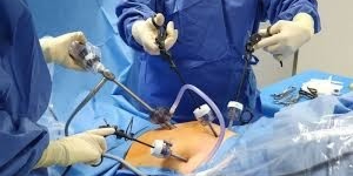 What makes liposuction a global cosmetic trend?