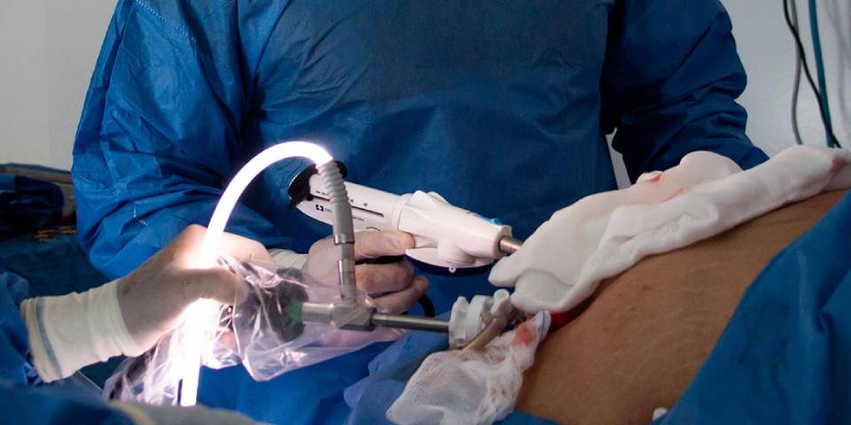 Appendix Removal Surgery in Bangalore | Dr.Bhushan Chittawadagi | Best Gastroenterologist in Bangalore