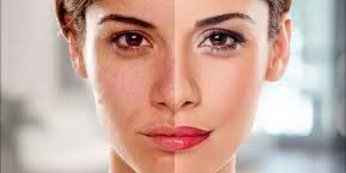 Advanced Skin Brightening and Whitening Treatments for Naturally Clear, Smooth, and Glowing Skin