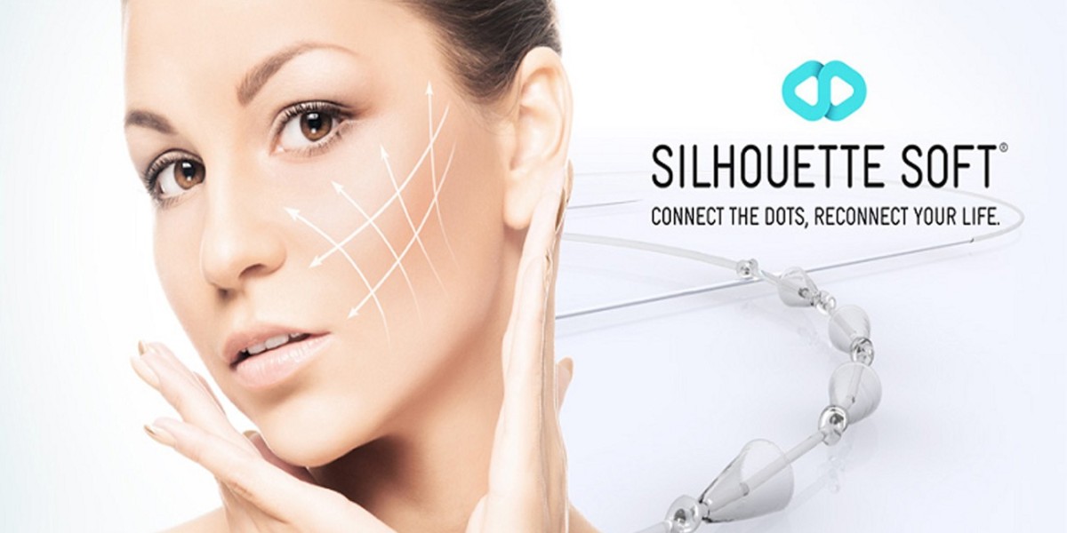 Addressing Common Concerns About Silhouette Soft Thread Lifts