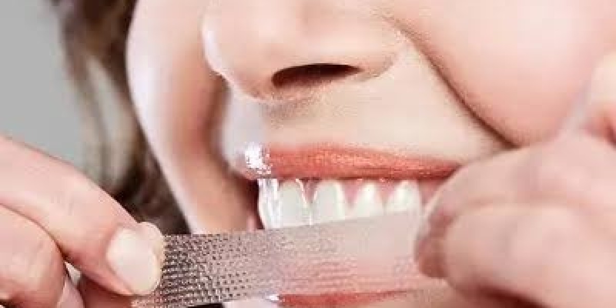 Zoom Teeth Whitening in Dubai – Brighten Your Smile Safely and Quickly