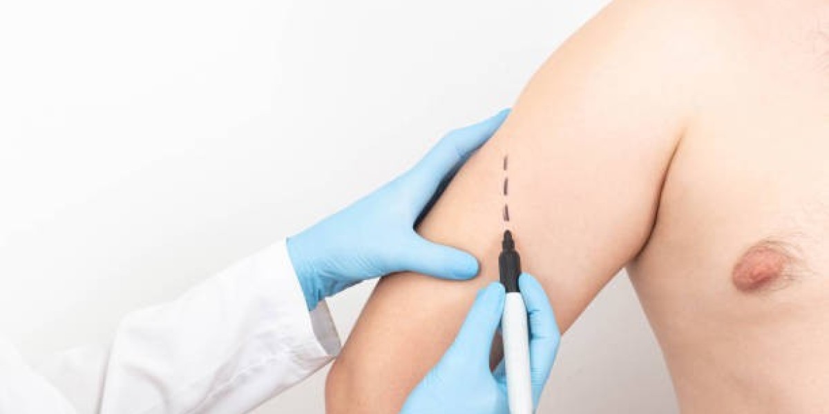 Is Arm Lift Surgery in Riyadh Right for You? Key Factors to Consider