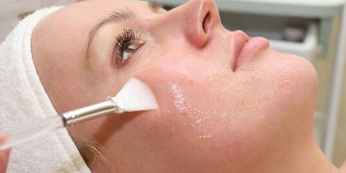 Chemical Peels in Dubai for Fresh Radiant Skin