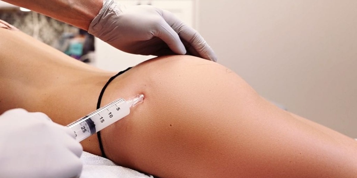 Are Butt Fillers Safe for Long-Lasting Body Contouring?