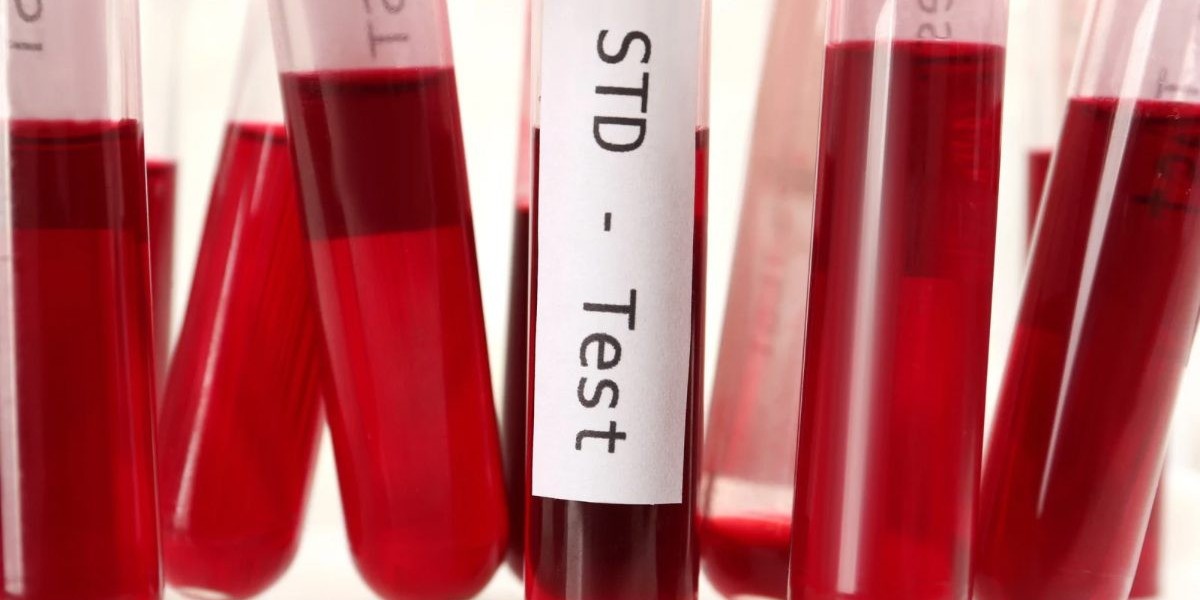 STD Test in Dubai: Why Regular Screening Matters Most