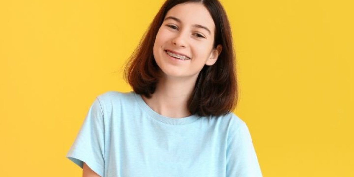 Can Braces Fix Overbites, Underbites, and Crowded Teeth?