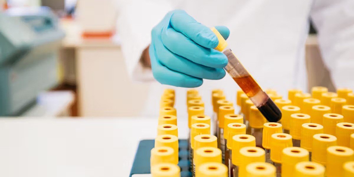 Preventive Healthcare: Why Routine Blood Testing Matters