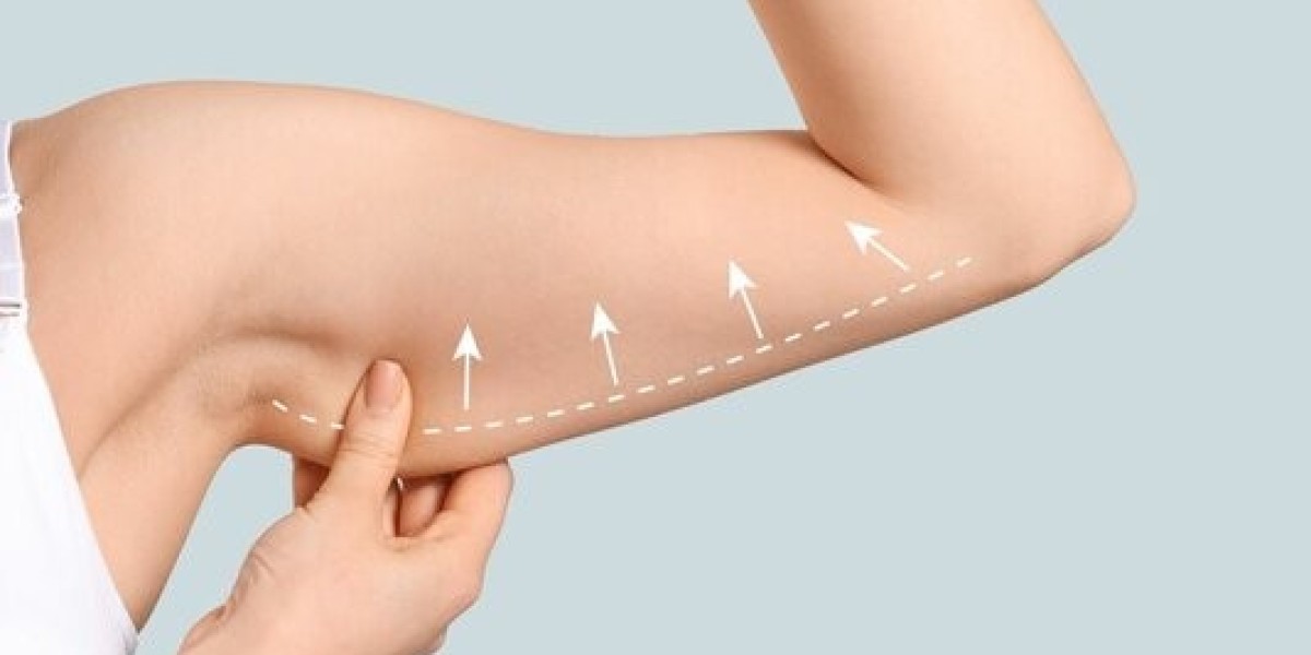 Arm Lift Surgery in Dubai for a Refined Upper Body Look