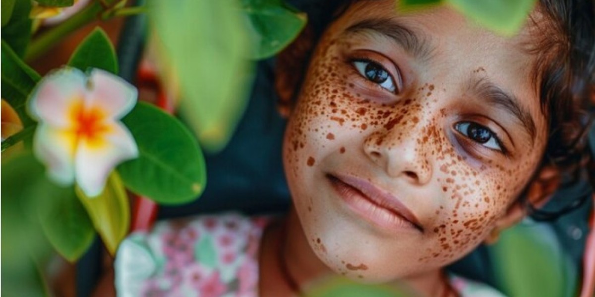 Homoeopathy and the Next Generation of Holistic Vitiligo Treatment