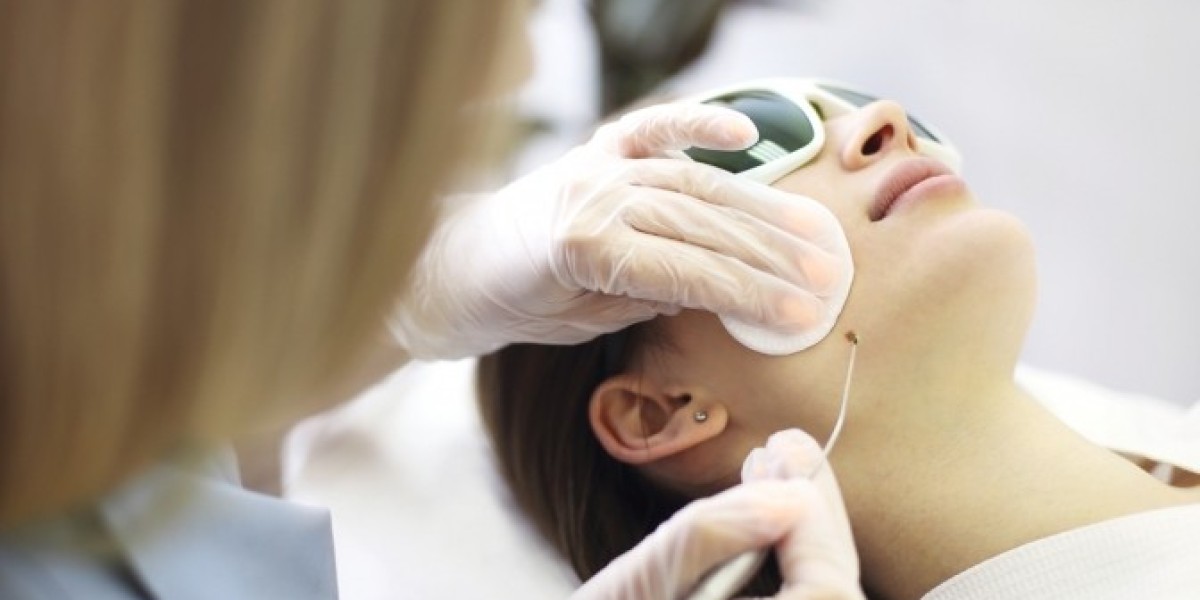 Understanding the Basics of Professional Skin Lesion Removal in Riyadh