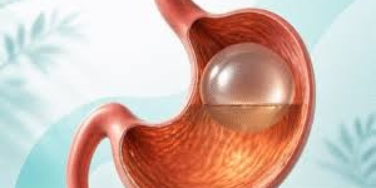 Is Gastric Balloon in Dubai Right for You? A Complete Guide to Weight Loss Success