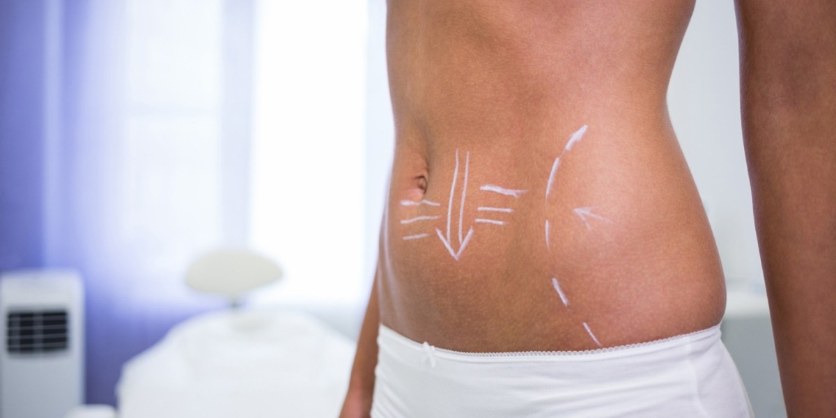 Best Tummy Tuck Surgeon in Dubai: How Experience Impacts Surgical Results