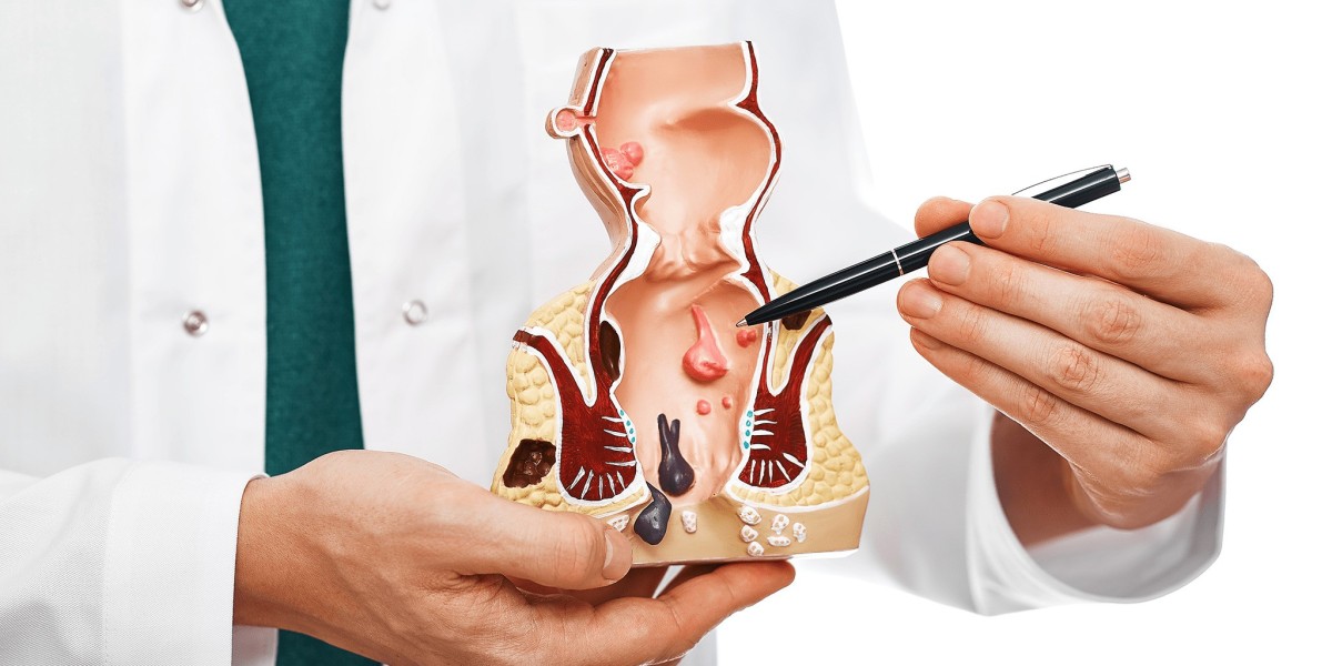 How Effective Is Piles Treatment for Long-Term Relief?