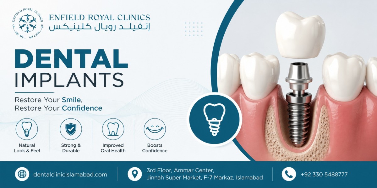 A Modern Solution for Stronger, Healthier Smiles Dental Implants: