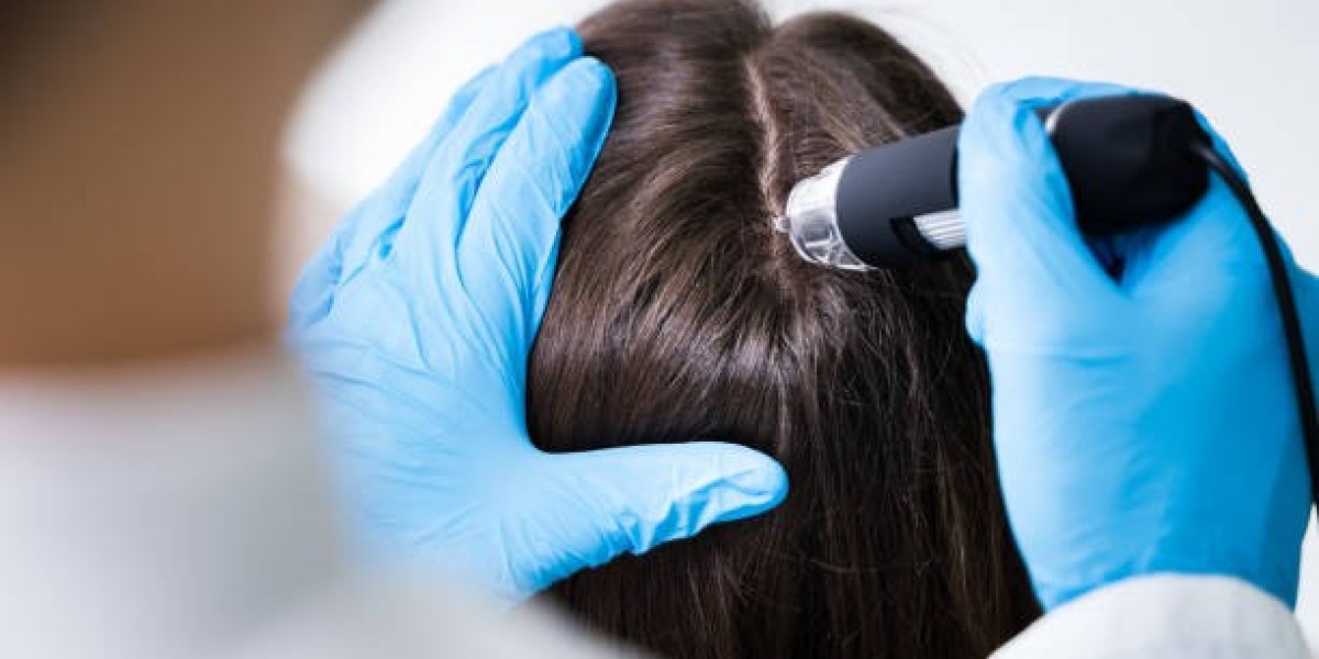 Exosome Hair in Dubai: The Natural Hair Restoration Breakthrough