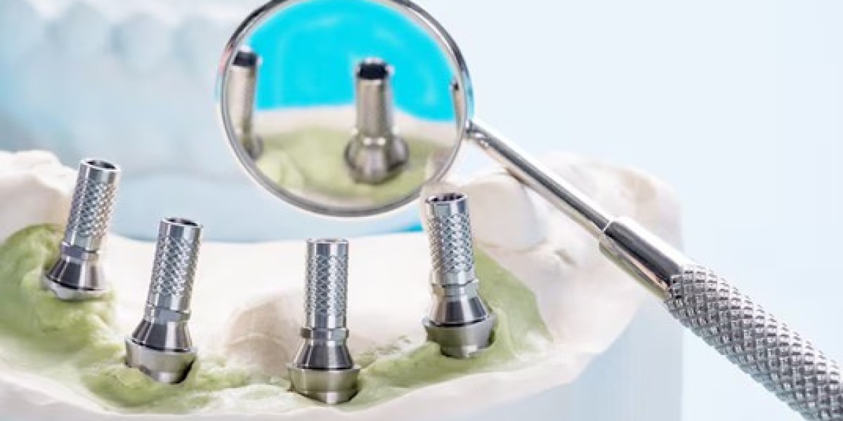 Guide to Dental Implants and Their Advantages a Path to a Confident Smile