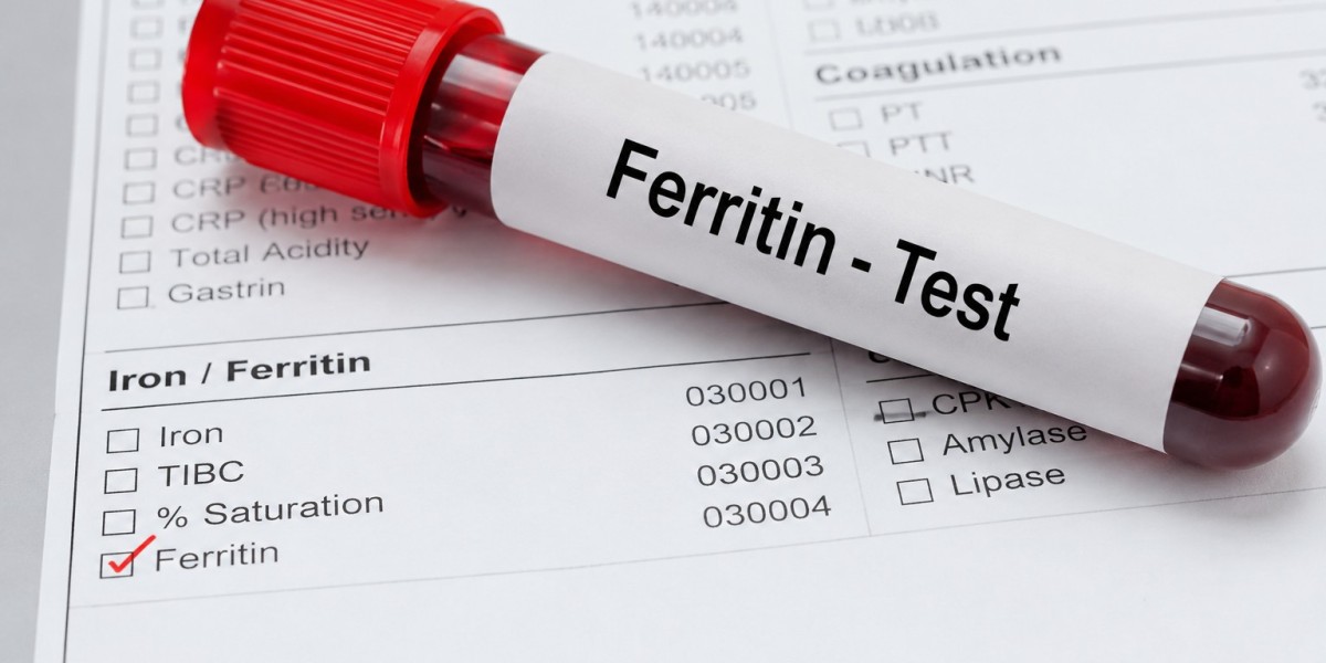 Global Ferritin Testing Market Insights: Key Factors Shaping Industry Growth