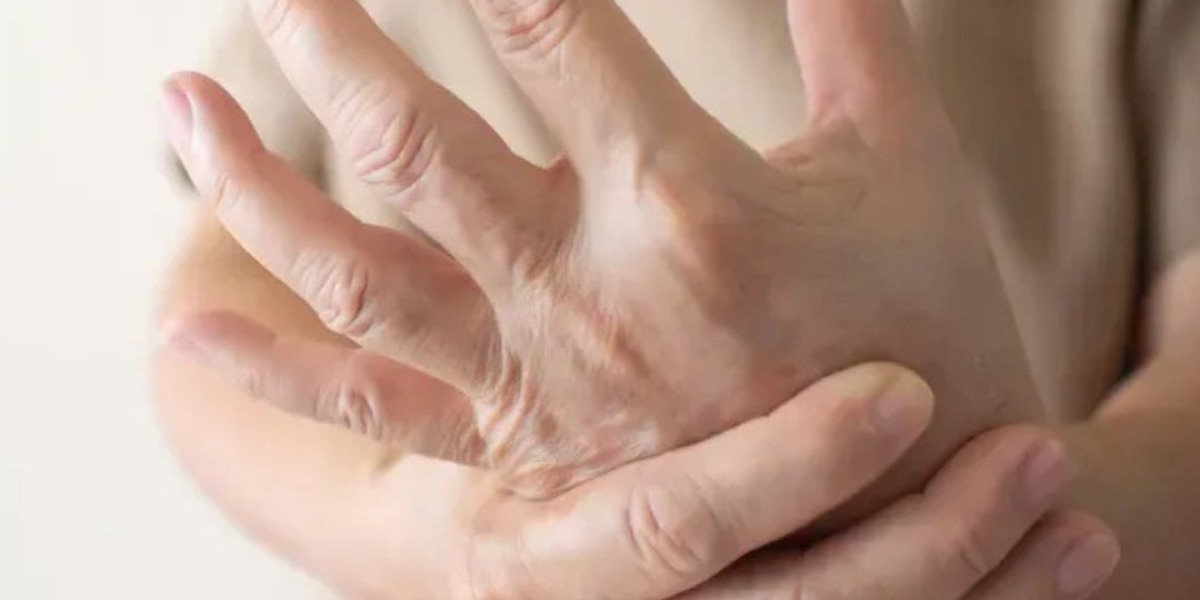 Inflammation, Arthritis, and Autoimmune Disease: What Rheumatology Can Treat