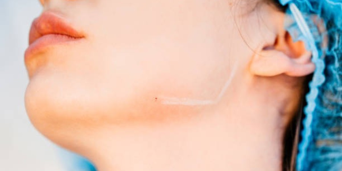 Where to Explore Facial Scar Revision in Dubai Treatment