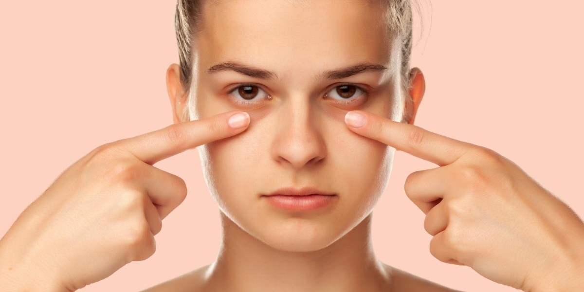 How to Choose the Right Dark Circles Treatment