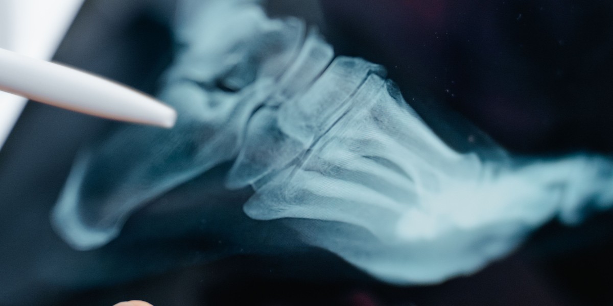 France Digital X-Ray Market Expected to Witness Significant Expansion Through 2035