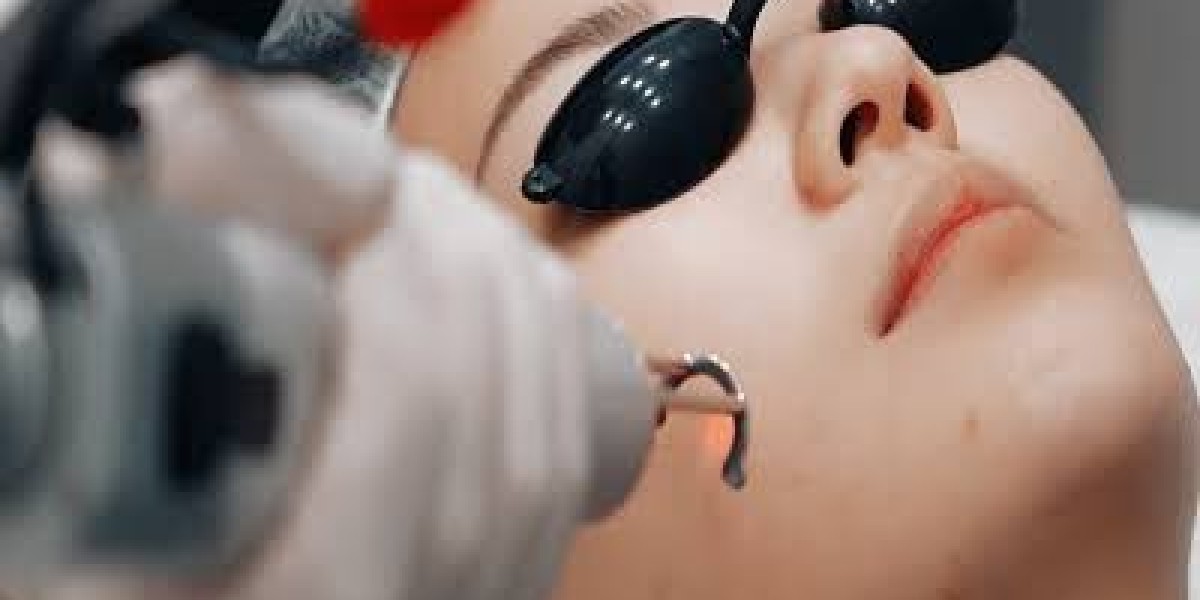 Pico Laser Treatment in Islamabad at Glamorous Clinic