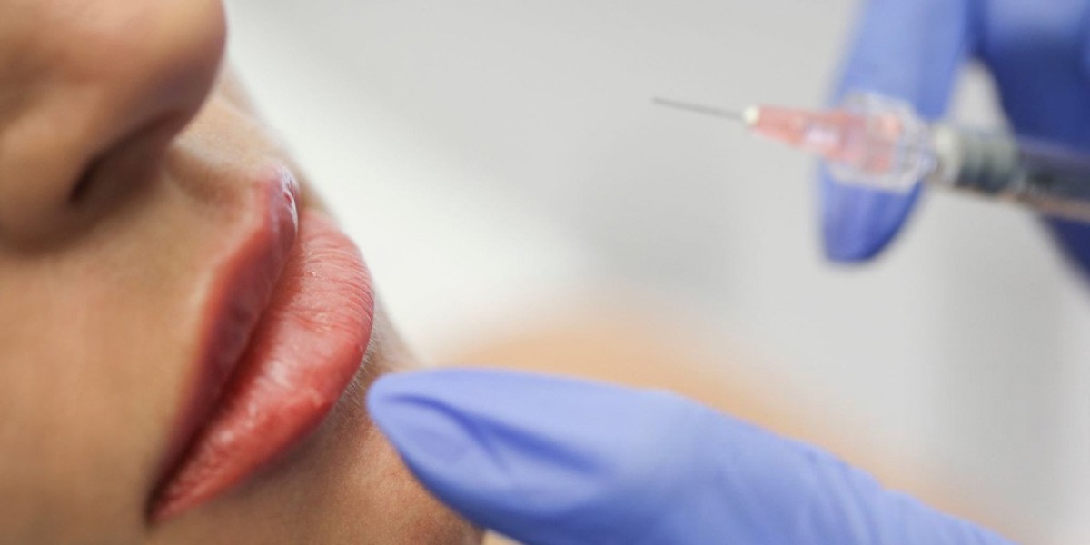Why Is Restylane Trusted for Natural-Looking Results?