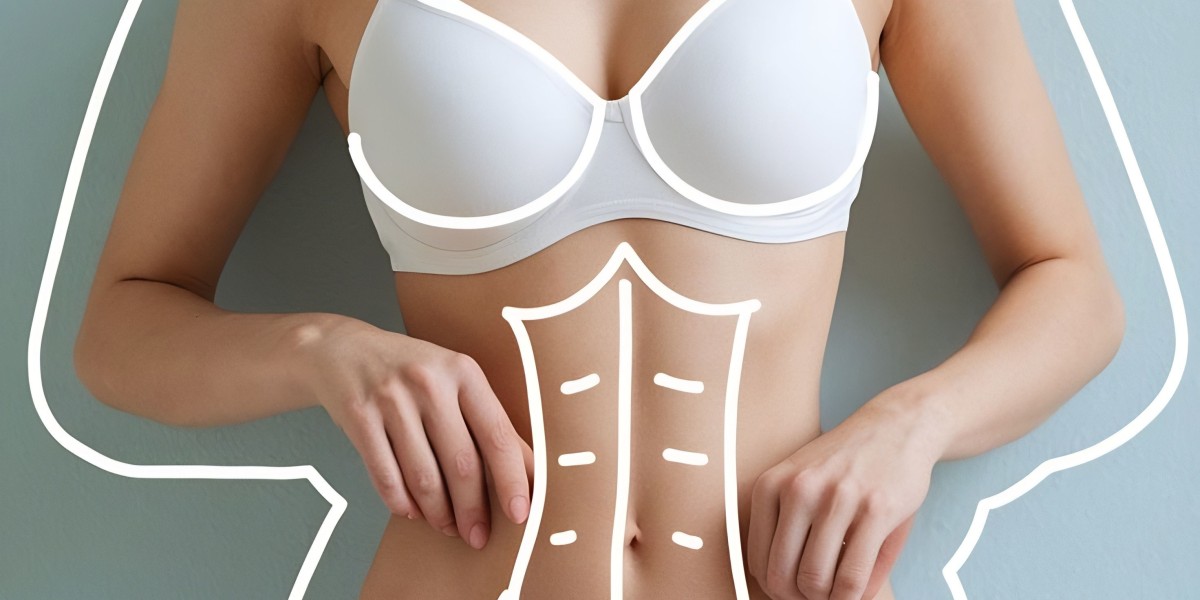 Preparing for Your Mommy Makeover Dubai Journey