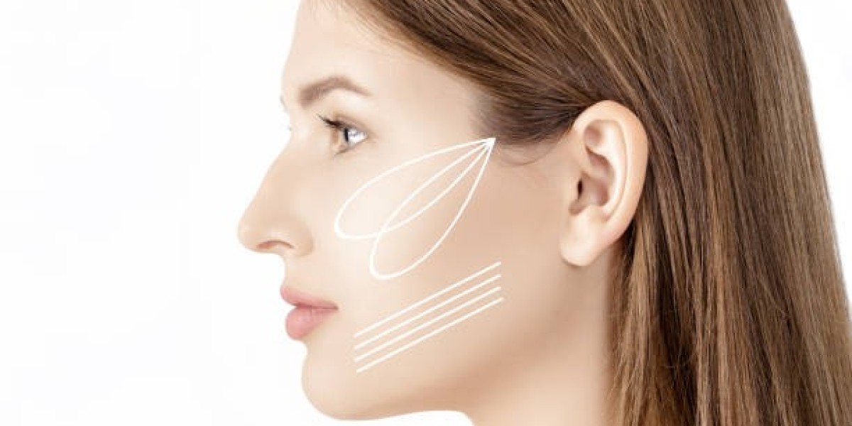 How Cheek Augmentation in Dubai Can Define Your Cheekbones