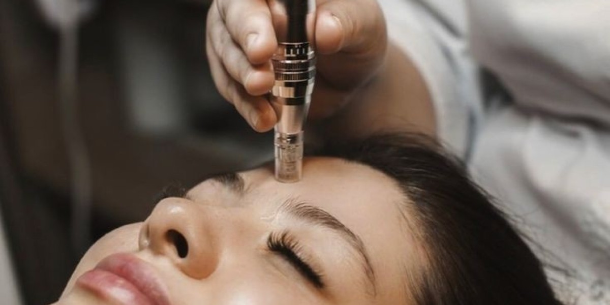 Microneedling with PRP in Dubai for Skin Renewal