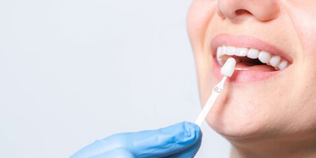 Can Porcelain Veneers Brisbane Fix Crooked Teeth?