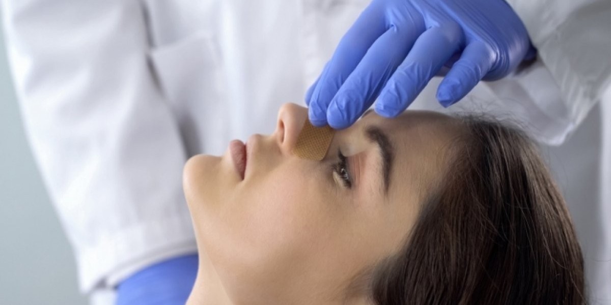 Rhinoplasty Surgery in Dubai and Modern Techniques