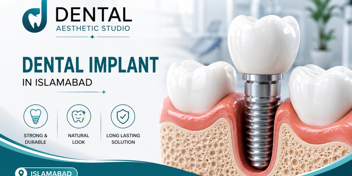 Affordable Dental Implants for a Beautiful Smile